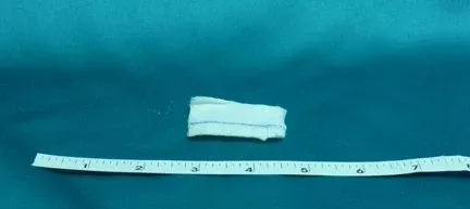 Bioseal Bioseal X-Ray Detectable Gauze Sponge Cotton 12-Ply 2 X 2 Inch Square Sterile - 7320/50